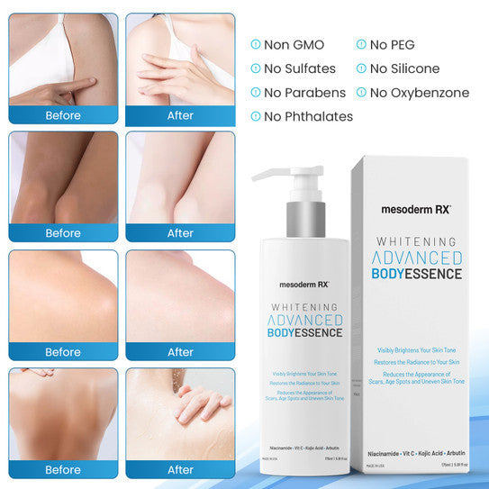 Mesoderm RX Whitening ADVANCED Body Essence Lotion Mesoderm RX Whitening ADVANCED Body Essence Lotion