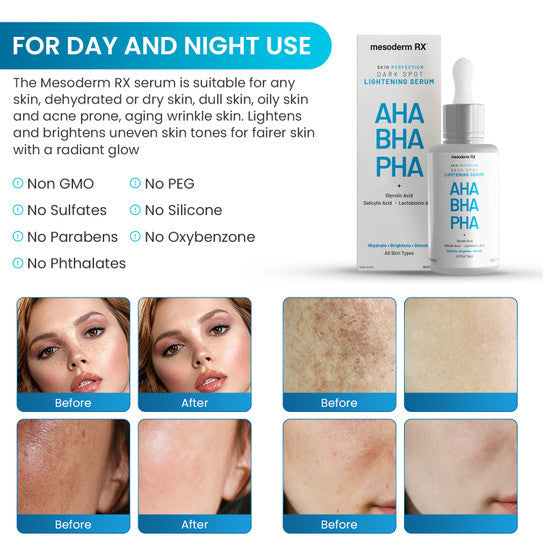 Mesoderm RX AHA BHA PHA DARK SPOT LIGHTNING Serum