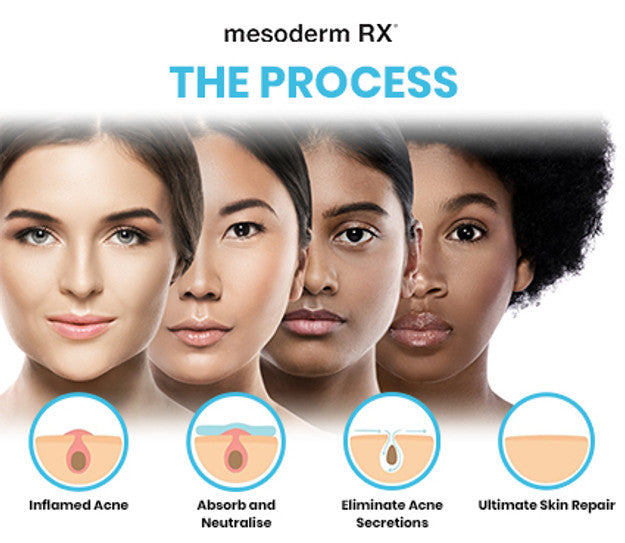 Mesoderm INTENSIVE Acne Patch Mesoderm INTENSIVE Acne Patch